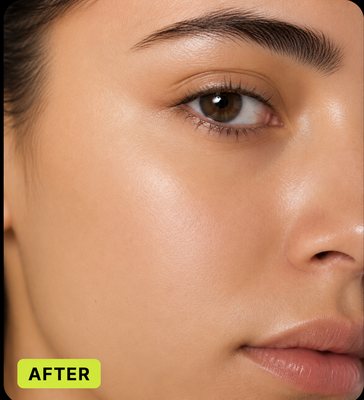 Skin after
